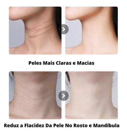 REMOVEDOR DE RUGAS - DERMA LIFTING